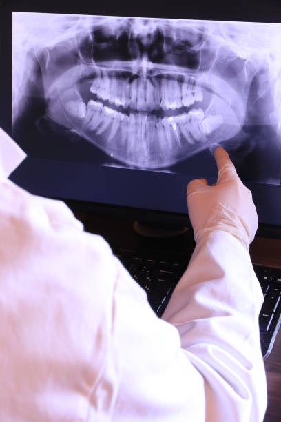 Best Emergency Gum Treatment in Falmouth, KY