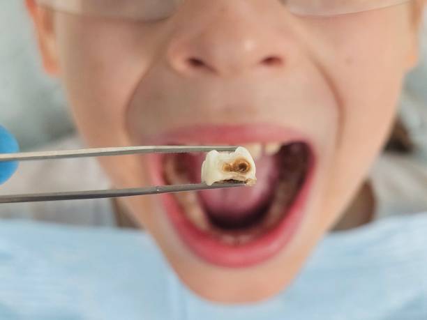 Best Weekend Emergency Dentist in Falmouth, KY